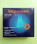 Valgucream - Крем від вальгусной деформації (ВальгуКрем), фото 3