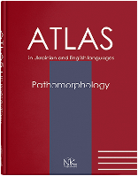 Патоморфологія = Pathomorphology : атлас укр. та англ. мовами.  Боднар Я. Я., Багрій М. М., Зербіно Д. Д. та