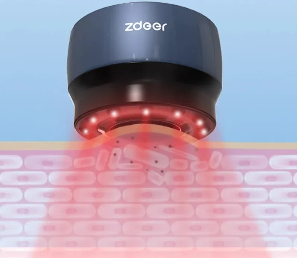 Масивна вакуумна банка Zdeer Антицелюлітна банка 2000mah (працює 100 мін), фото 1