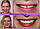 Вініри для зубів — PERFECT SMILE VENEER (накладні зуби), фото 6