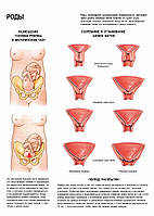 Роды. Период раскрытия - плакат