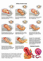 Период изгнания плода - плакат