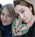 Комплекс "Для жирної пористої шкіри" Джерелія, фото 8