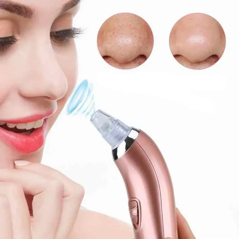 Вакуумний очисник шкіри Beauty Skin XN-8030 Рожевий