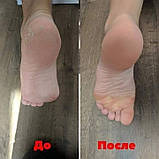 Крем для ніг від сухості та тріщин, 75 мл Джерелія, фото 9