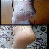 Крем для ніг від сухості та тріщин, 75 мл Джерелія, фото 10