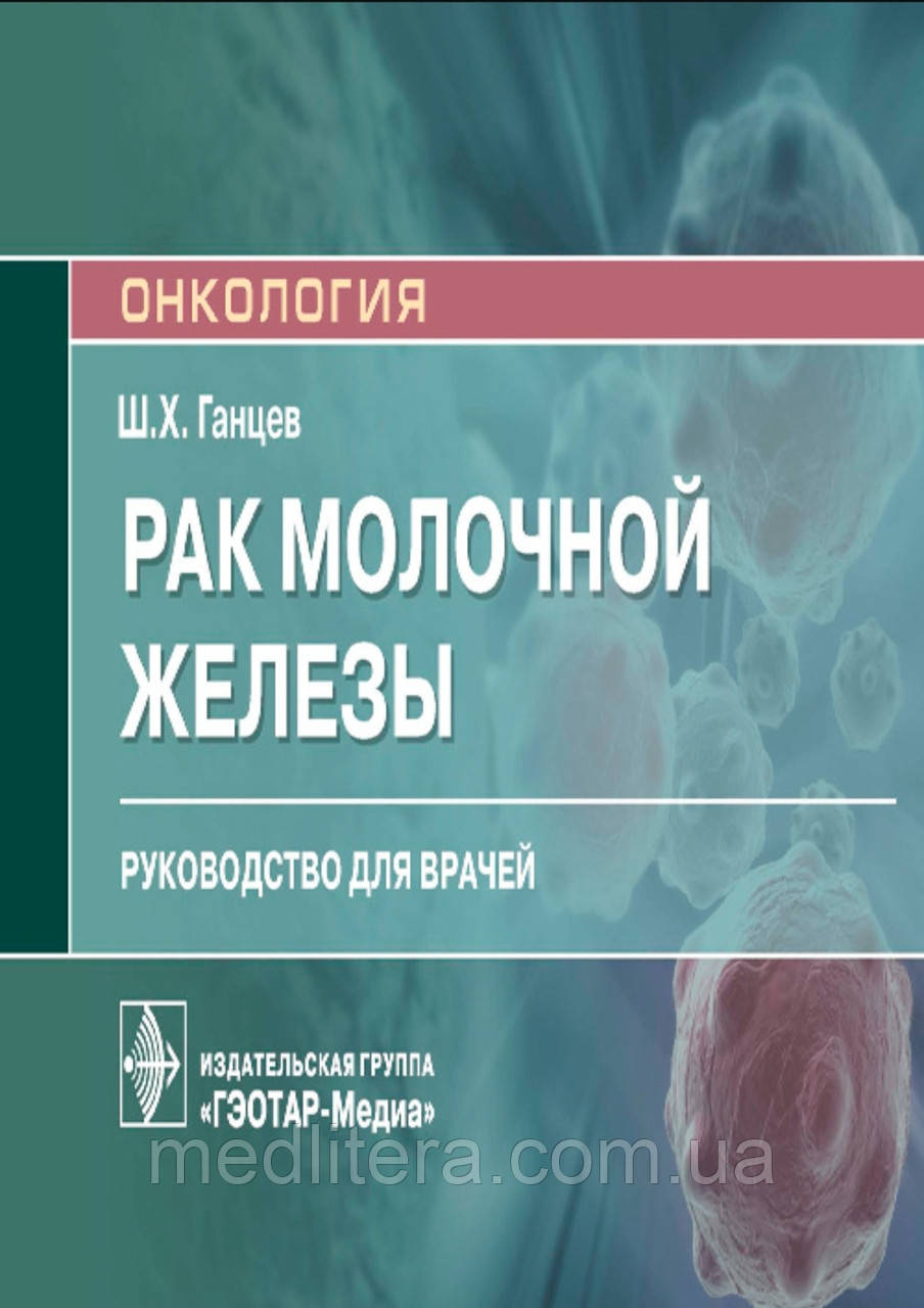 Ганців Ш.Х. Рак молочної залози. Посібник для лікарів 2021 рік