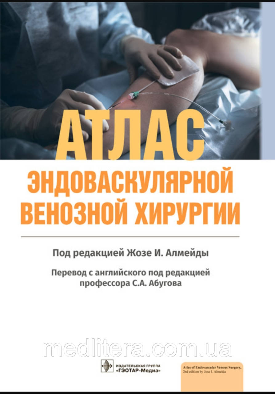 Ж.І. Алмейди; Пер. с англ.; Под ред. С.А. Абугова. Атлас ендоваскулярної венозної хірургії