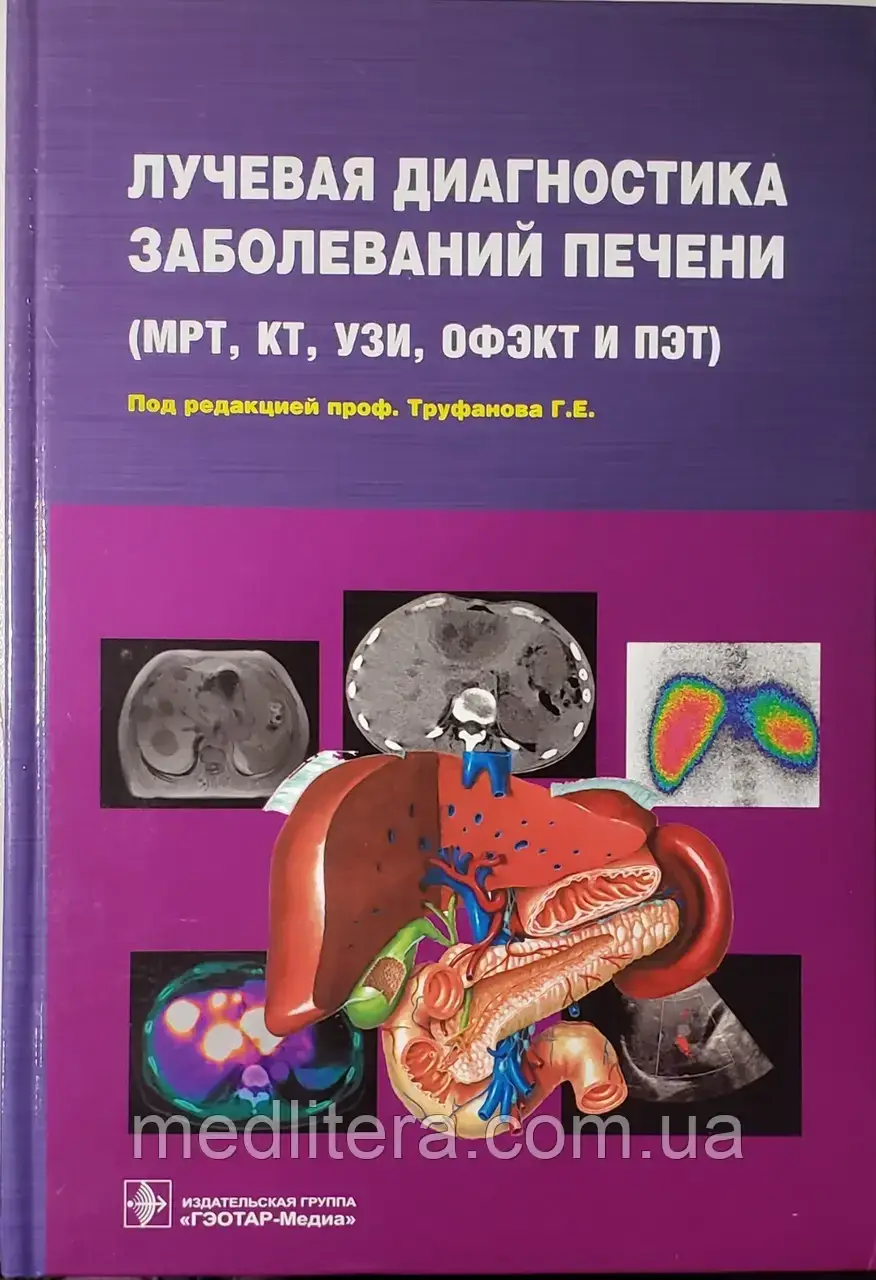 Труфанів Г.Е. Променева діагностика захворювань печінки (МРТ, КТ, ОФЕКТ і ПЕТ)