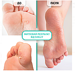 Гель-кератолітик для локального застосування М'яке лезо Shelly 100 мл, фото 4