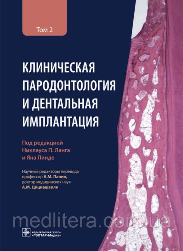 Ланг Н.П. Клінічна пародонтологія та детальна імплантація: у 2-х т. Том 2