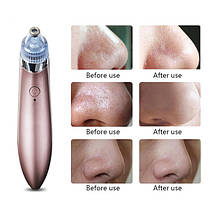 Вакуумний апарат для чищення пор Beauty Skin Care Specialist XN-8030, Апарат для чищення обличчя, SBm, фото 6
