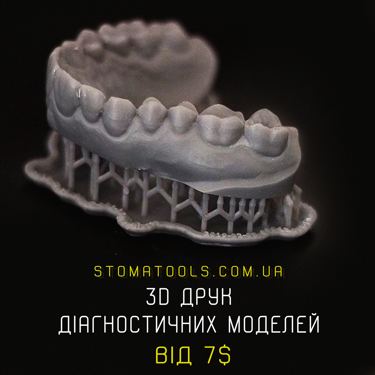 3D Друк діагностичних моделей