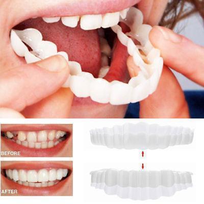 Съемные виниры Veneers Snap-on smile | Виниры для зубов! Лучший товар - фото 3 - id-p1420765659