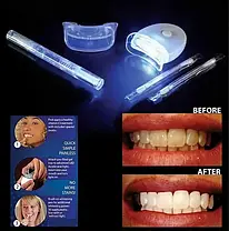 Засіб для відбілювання зубів в домашніх умовах 20 Minute Dental White, фото 2