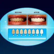 Засіб для відбілювання зубів в домашніх умовах 20 Minute Dental White, фото 3