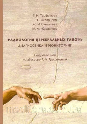 Радіологія церебральних гліом: діагностика та моніторинг (брак)
Т.Н. Трофімів