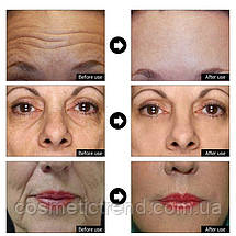 Lanbena Six Peptide Serum 24K Gold Anti-aging skin Сироватка антивікова для обличчя 15 мл, фото 6