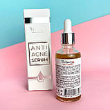 Сироватка для проблемної шкіри обличчя Top Beauty, фото 2