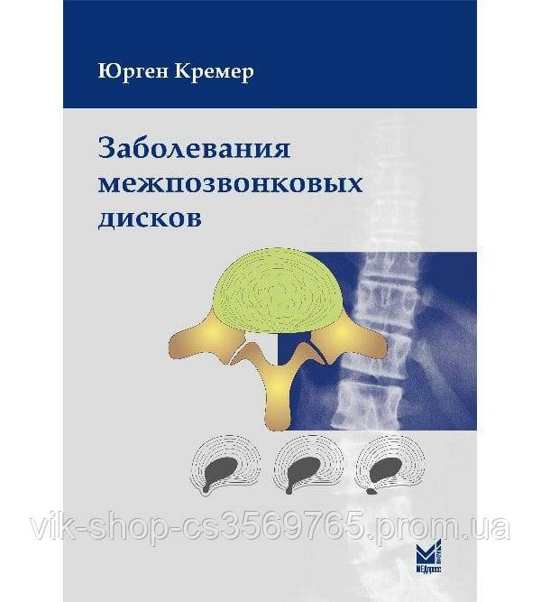 Межпозвоночные Диски | Сравнить Цены И Купить На Prom.Ua