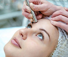 Алмазна мікродермабразія + DermaOxy