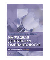 Наглядная дентальная имплантология Мале Ж. Мора Ф. 2021г.