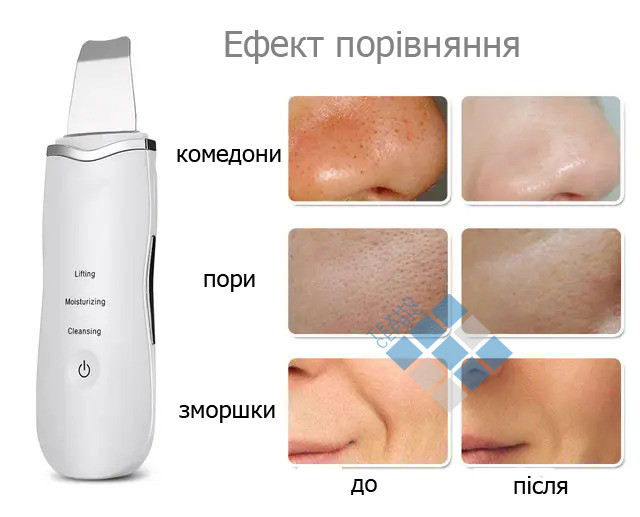 Апарат для ультразвукового чищення лиця