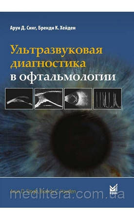 Сінг А. Д. , Хейден Б. К. Ультразвукова діагностика в офтальмології