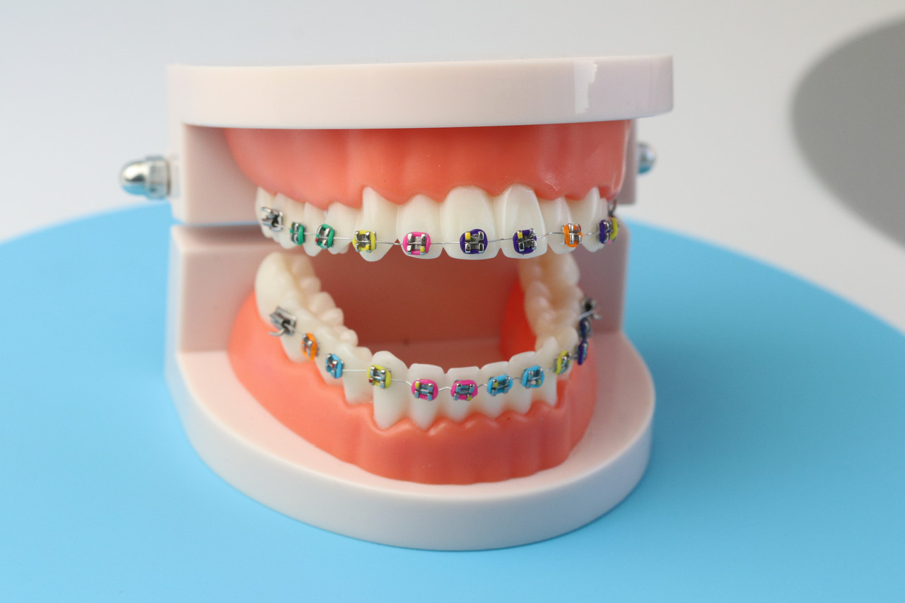 Демонстрационная модель челюсти с брекетами