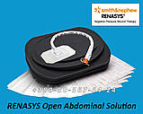 Розчин для відкритої черевної порожнини для терапії ран NPWT RENASYS Open Adominal Solution, фото 4