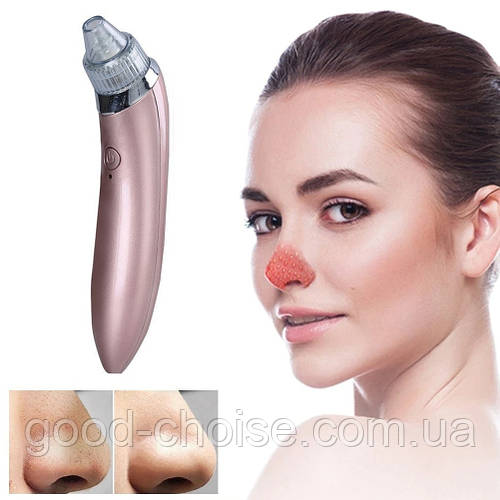 Купити Вакуумний апарат для чищення обличчя Beauty Skin Care Specialist