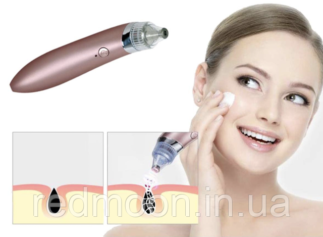 Вакуумный аппарат для чистки лица Beauty Skin Care Specialist XN-8030 ...