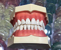 Зубна модель без артикулятора, 28 зубів