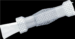Стравохідний стент Niti-S Double Anti Reflux, TaeWoong