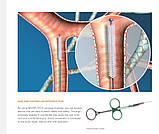 Цитологічна щітка, MICRO-TECH, фото 5