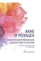 Акне и розацеа. Клинические проявления, диагностика и лечение Л.С. Круглова