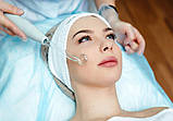 Дарсонваль косметологічний апарат X-TECH LIZ-006A для догляду за шкірою обличчя і тіла, 4 насадки, Польща, фото 10
