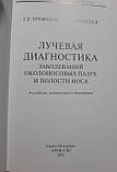 Труфанов Р. Е. Променева діагностика навколоносових пазух і порожнини носа, фото 3
