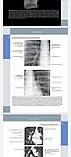 Федерле М. П. Променева анатомія. Груди, живіт, таз., фото 9