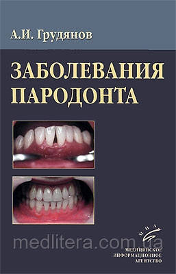 Грудянів А.І. - Захворювання пародонту
