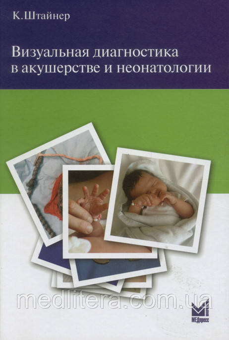 Штайнер К. Візуальна діагностика в акушерстві та неонатології