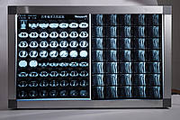 Медицинская пленка для цифровых изображений (Рентгеновская пленка)