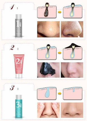 Набір для видалення чорних цяток BioAqua 3 в 1, фото 2