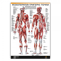 Плакат "Фізіотерапія-тригерні точки" 30см х 42см (1 плакат)