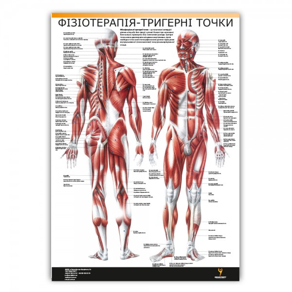 Плакат "Фізіотерапія-тригерні точки" 30см х 42см (1 плакат)