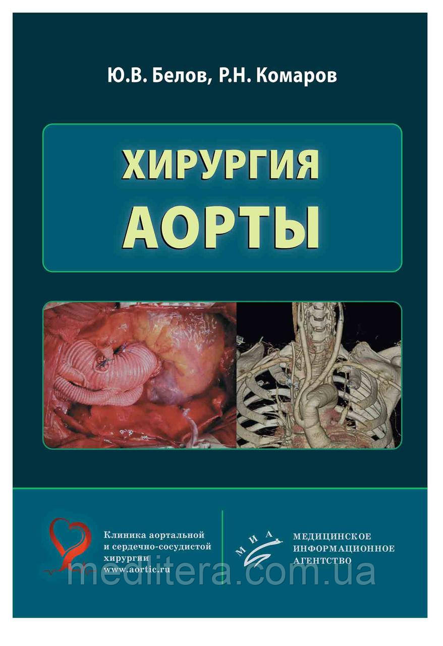 Білов Ю.В. Комаров Р.Н. ХІРУРГІЯ АОРТИ Посібник для лікарів та студентів