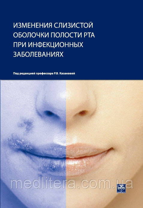 Зміни слизової оболонки порожнини рота під час інфекційних захворювань. Навчальний посібник Казакова Р. В