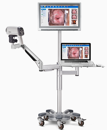 Кольпоскопи