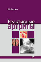 Бадокін В.В. Реактивні артрити. Урогенітальні та постентероколітичні