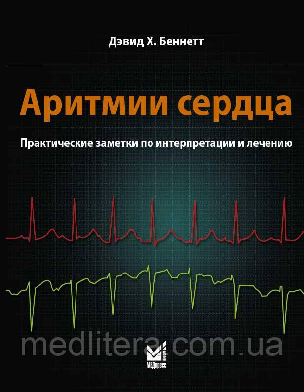 Беннет. Аритмії серця